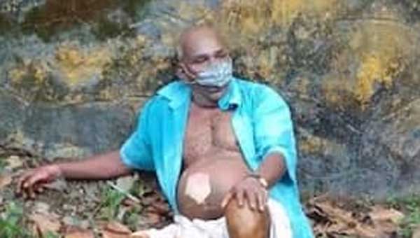 ദമ്പതികളെ തീകൊളുത്തി കൊലപ്പെടുത്തുന്നതിനിടെ പൊള്ളലേറ്റ പ്രതിയും മരിച്ചു ദമ്പതികളെ തീകൊളുത്തി കൊലപ്പെടുത്തുന്നതിനിടെ പൊള്ളലേറ്റ പ്രതിയും മരിച്ചു